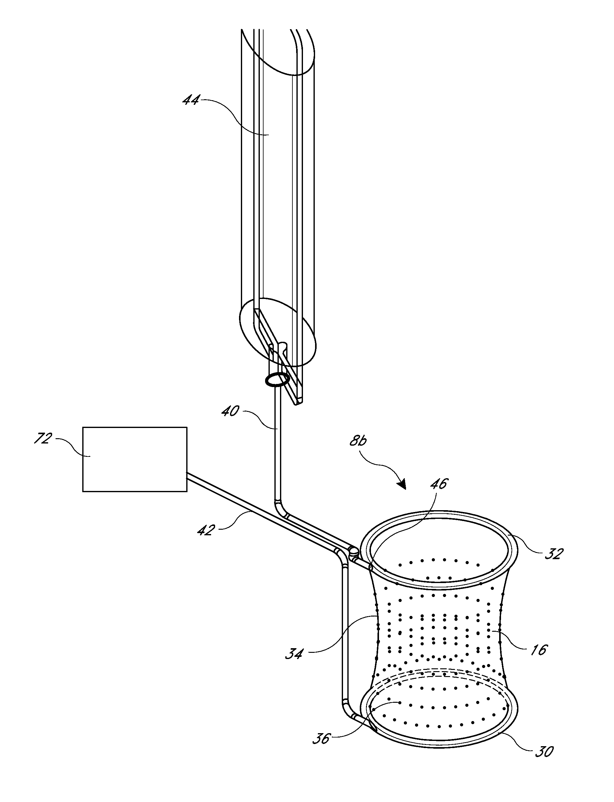 Methods for the prevention of surgical site infections