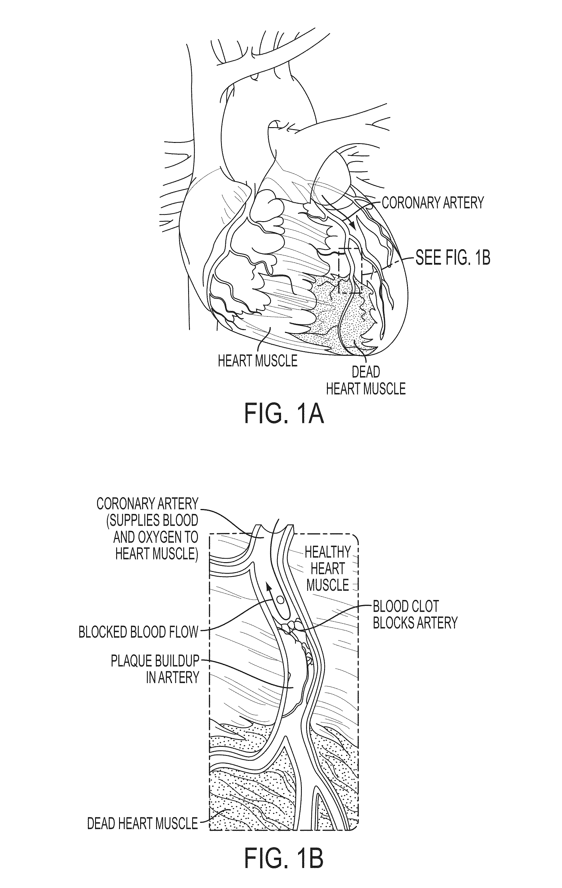Method and System for Multi-Scale Anatomical and Functional Modeling of Coronary Circulation