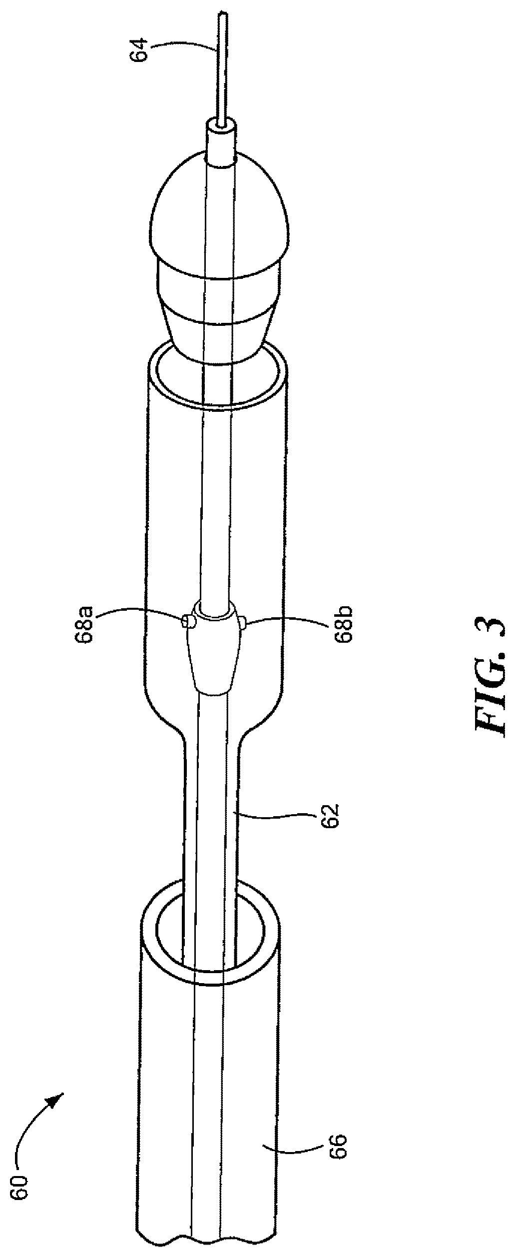 Transcatheter device and minimally invasive method for constricting and adjusting blood flow through a blood vessel