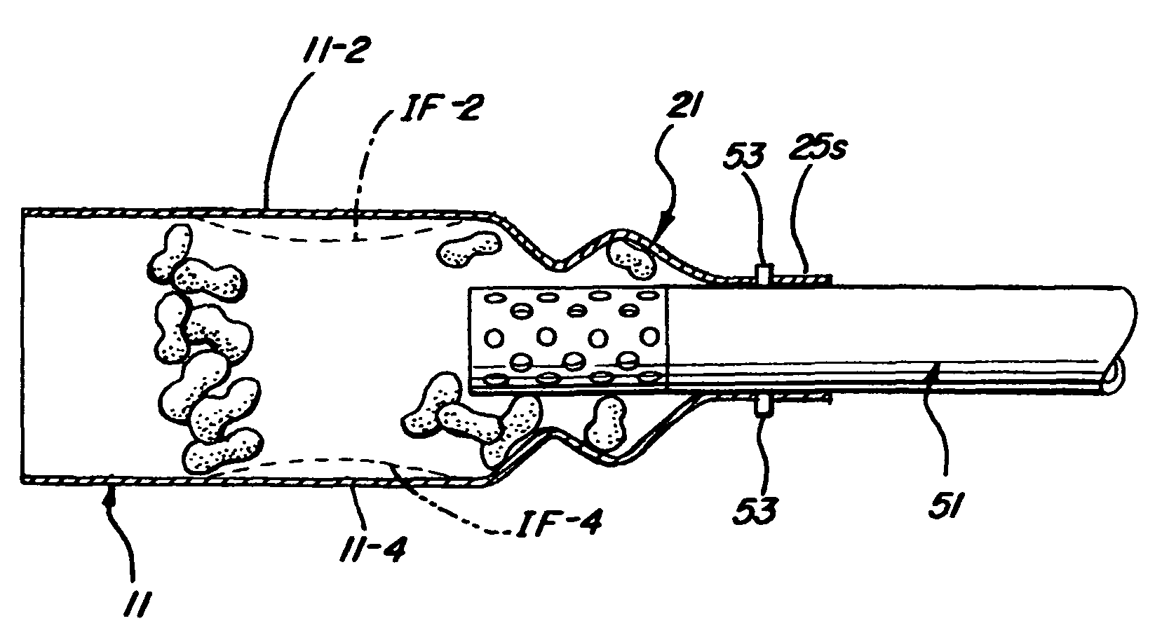 Apparatus for collecting lightweight packing particulates