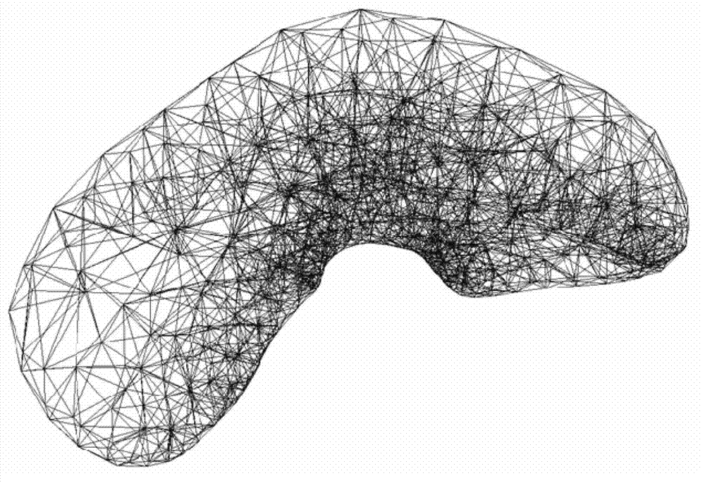 Real-time simulation method for embedded suture technology