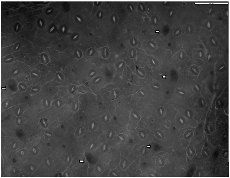 Microscopic slide preparation method for observing characteristics of lower surface of folium artemisiae argyi