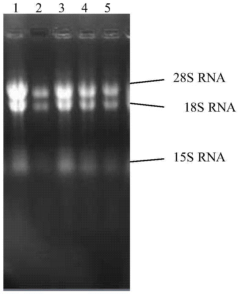 Arginase derived from Cordyceps Chinese Hirsutella, coding gene and application thereof