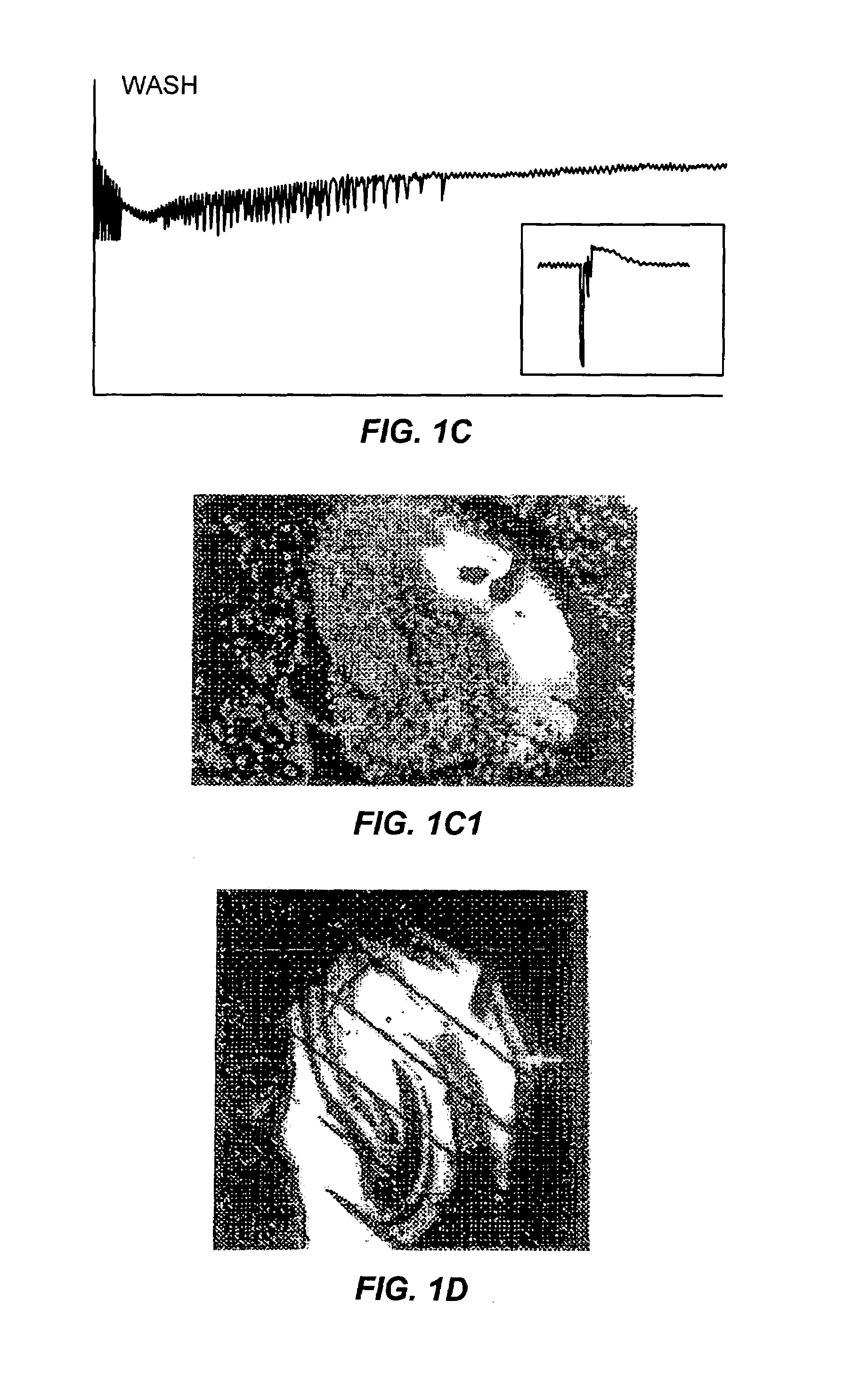 Method of treating migraine headache without aura