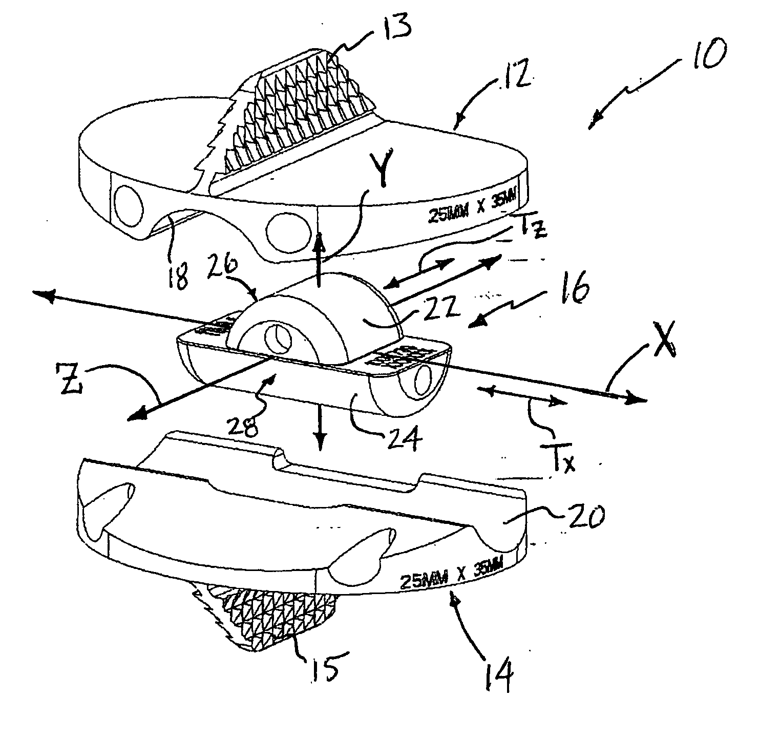 Total disc replacement system and related methods