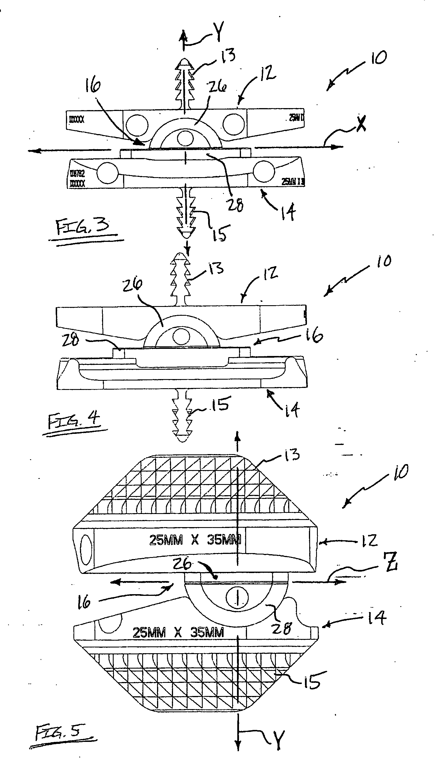 Total disc replacement system and related methods