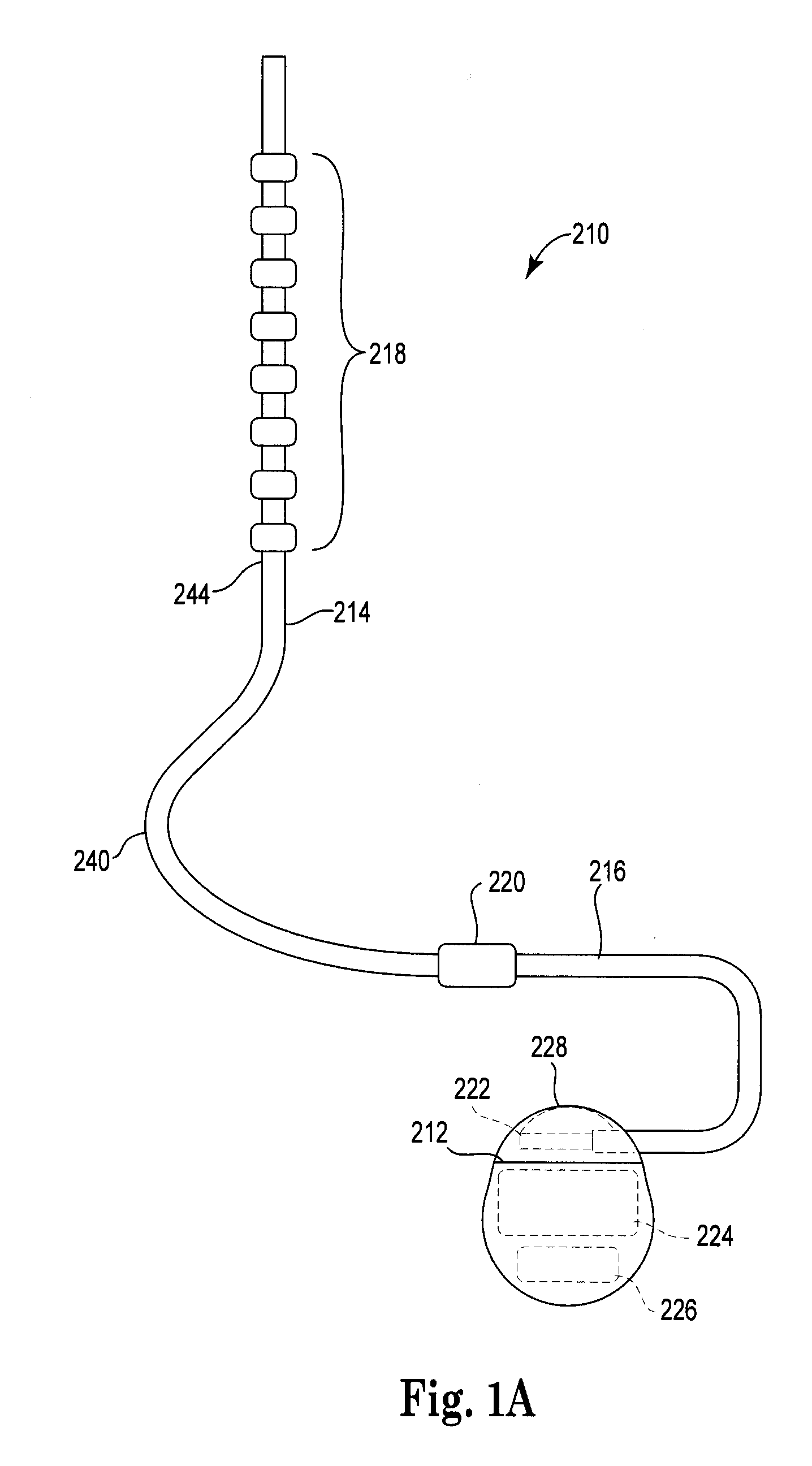 Pre-sutured anchor for implantable leads