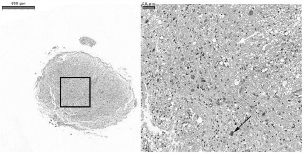 Gene marker for diagnosing spinal cord injury and screening spinal cord injury treatment drugs