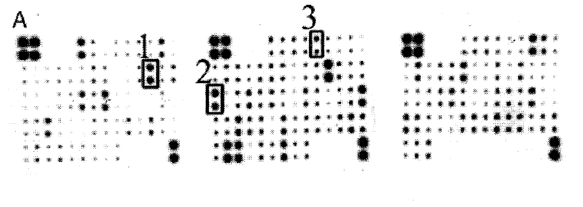 Kit for detecting premature rupture of membrane, and preparation method thereof