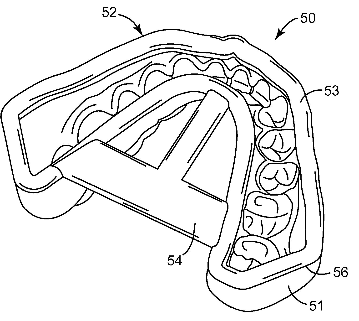 Digitally forming a dental model for fabricating orthodontic laboratory appliances