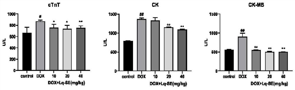 A pharmaceutical composition for preventing and treating cardiotoxicity of anthracycline antibiotics and its application