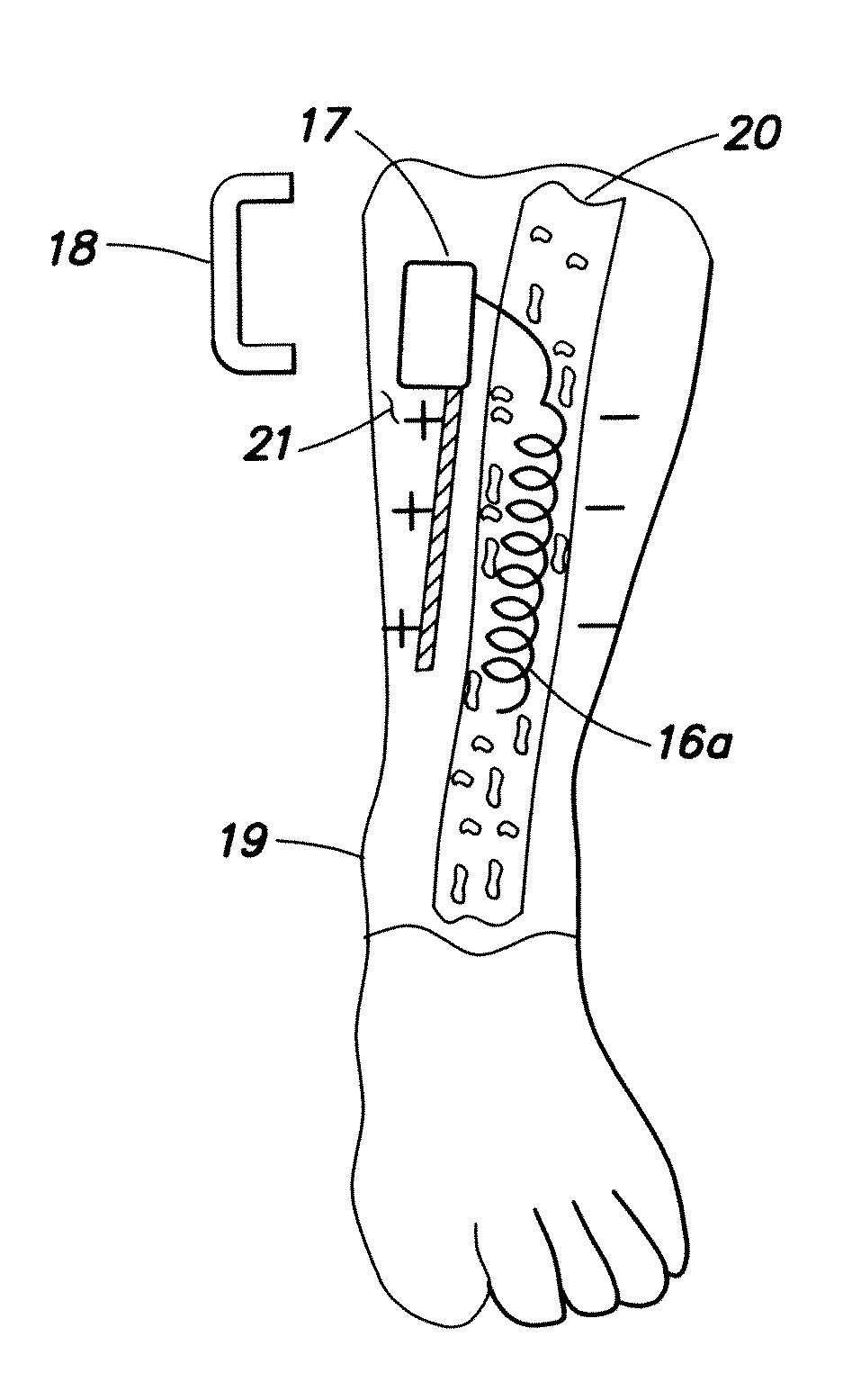 Systems and methods for delivering electrical energy in the body