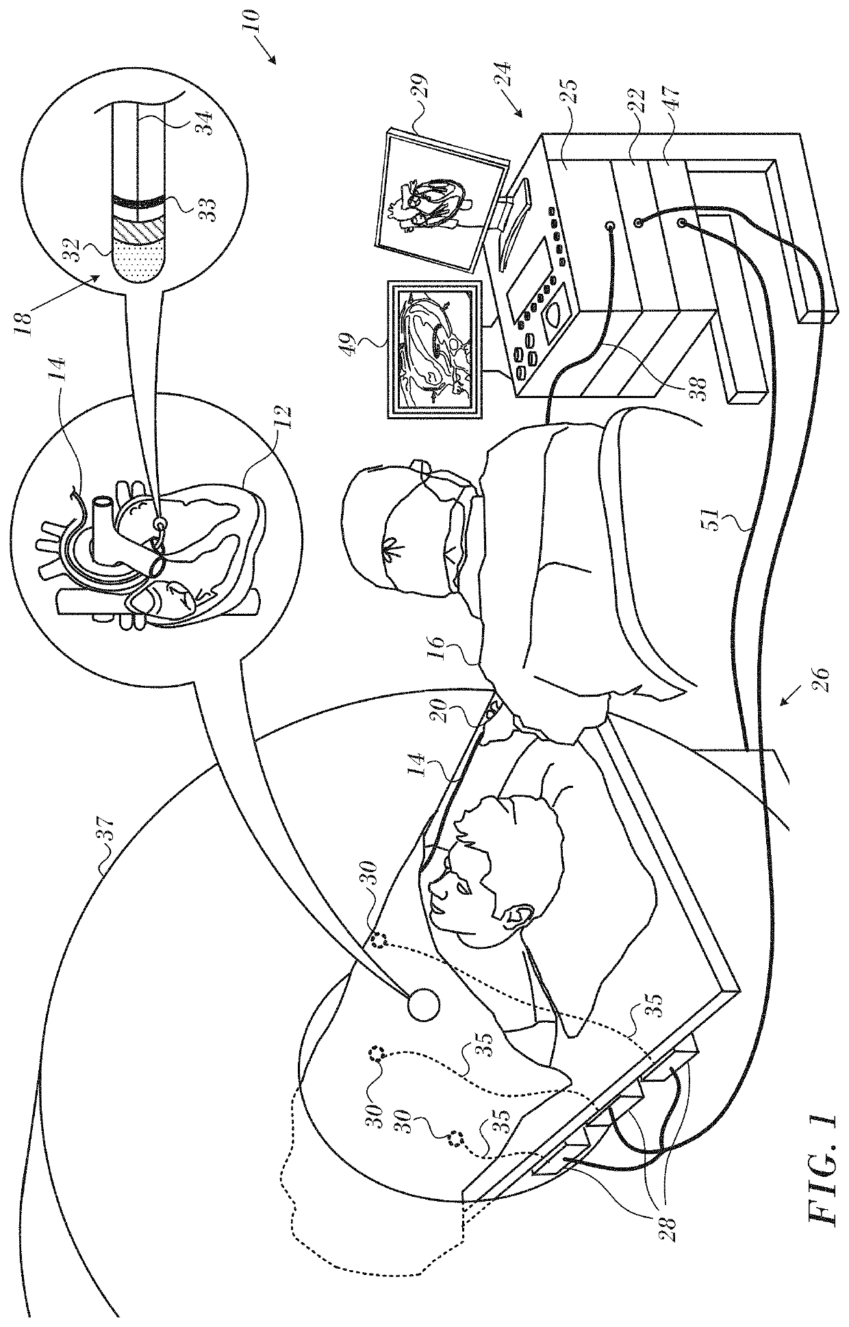 Magnetic resonance thermometry during ablation