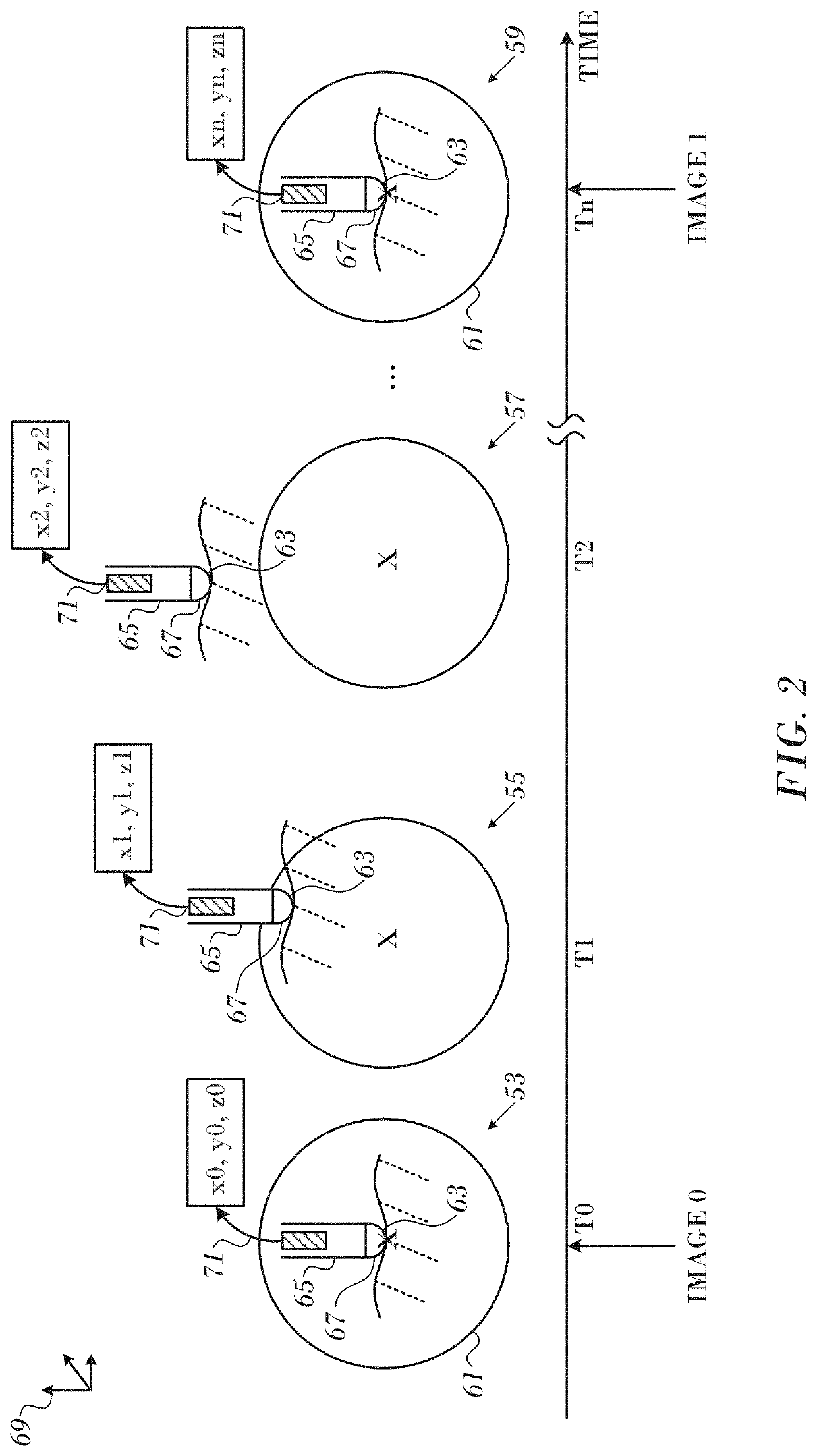 Magnetic resonance thermometry during ablation