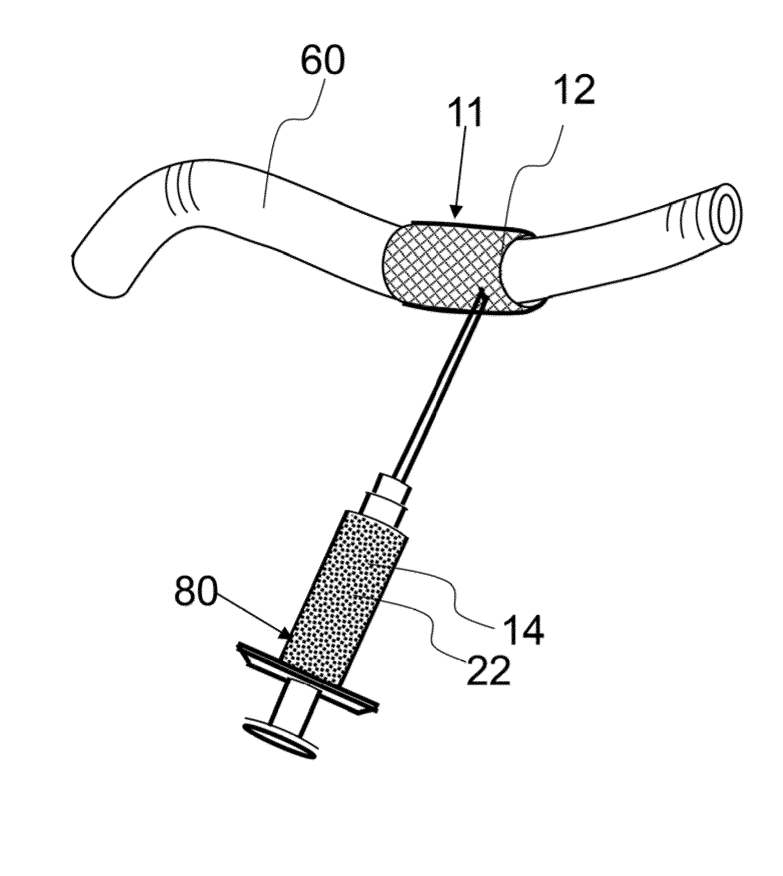 Method of treatment utilizing an acellular amnion derived therapeutic composition