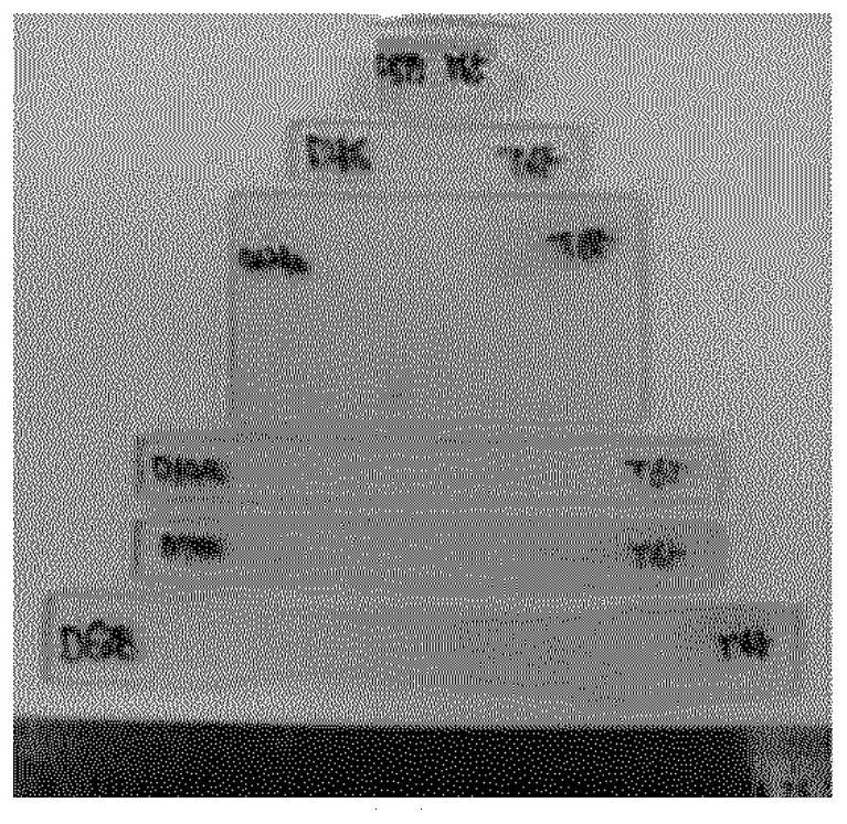 Photocurable composition for 3D printer for producing transparent orthodontic device