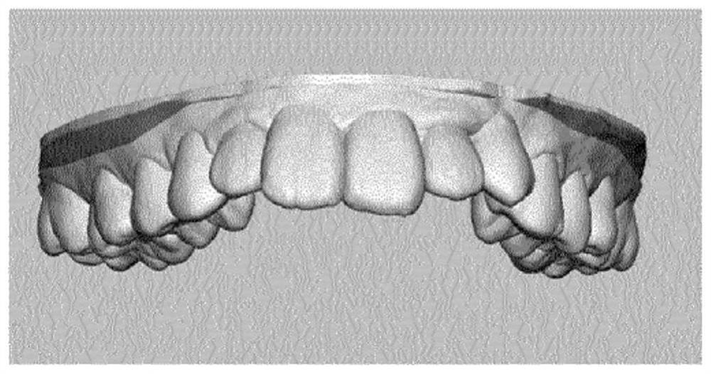 Photocurable composition for 3D printer for producing transparent orthodontic device