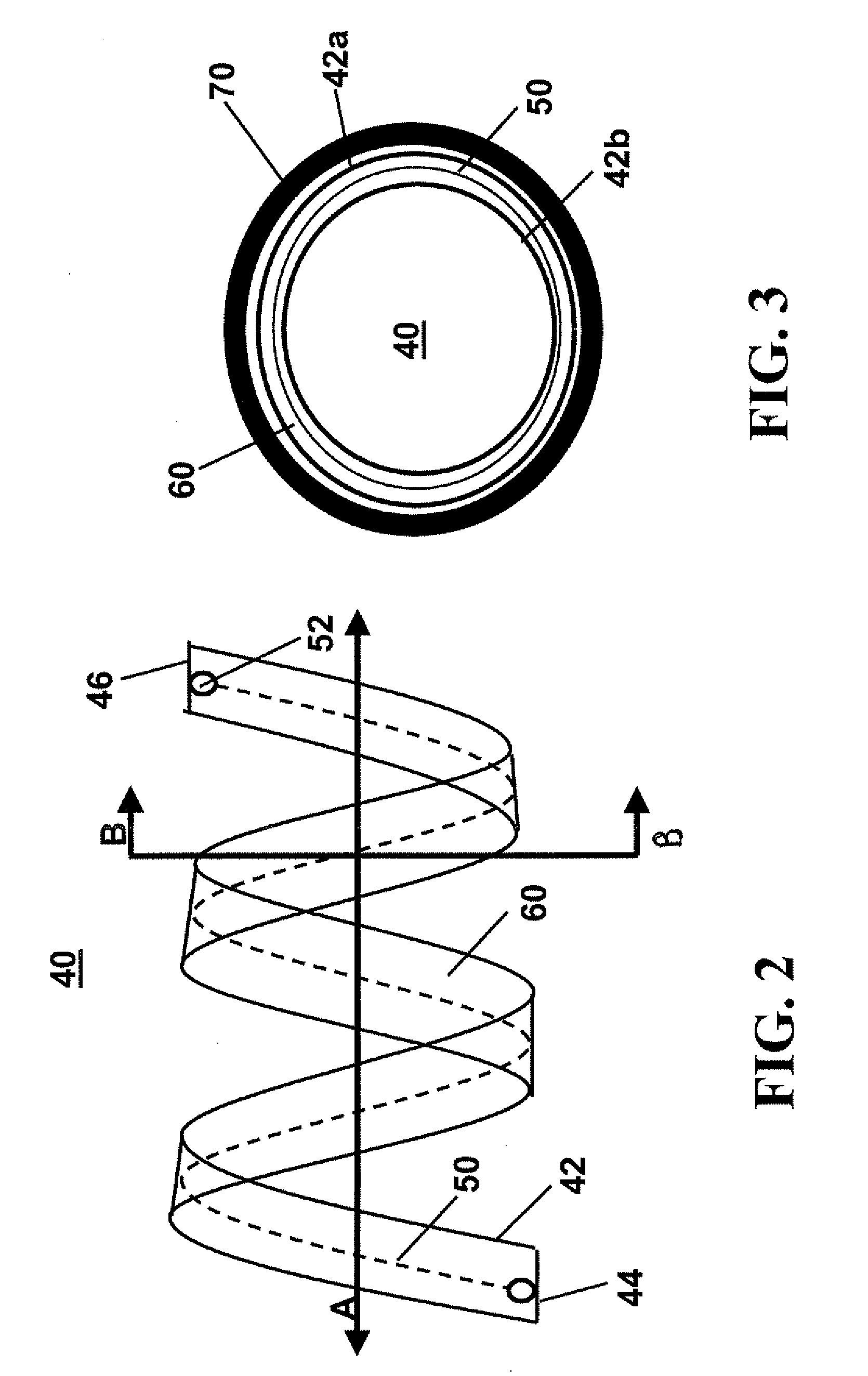 Stent, intraluminal stent delivery system, and method of treating a vascular condition