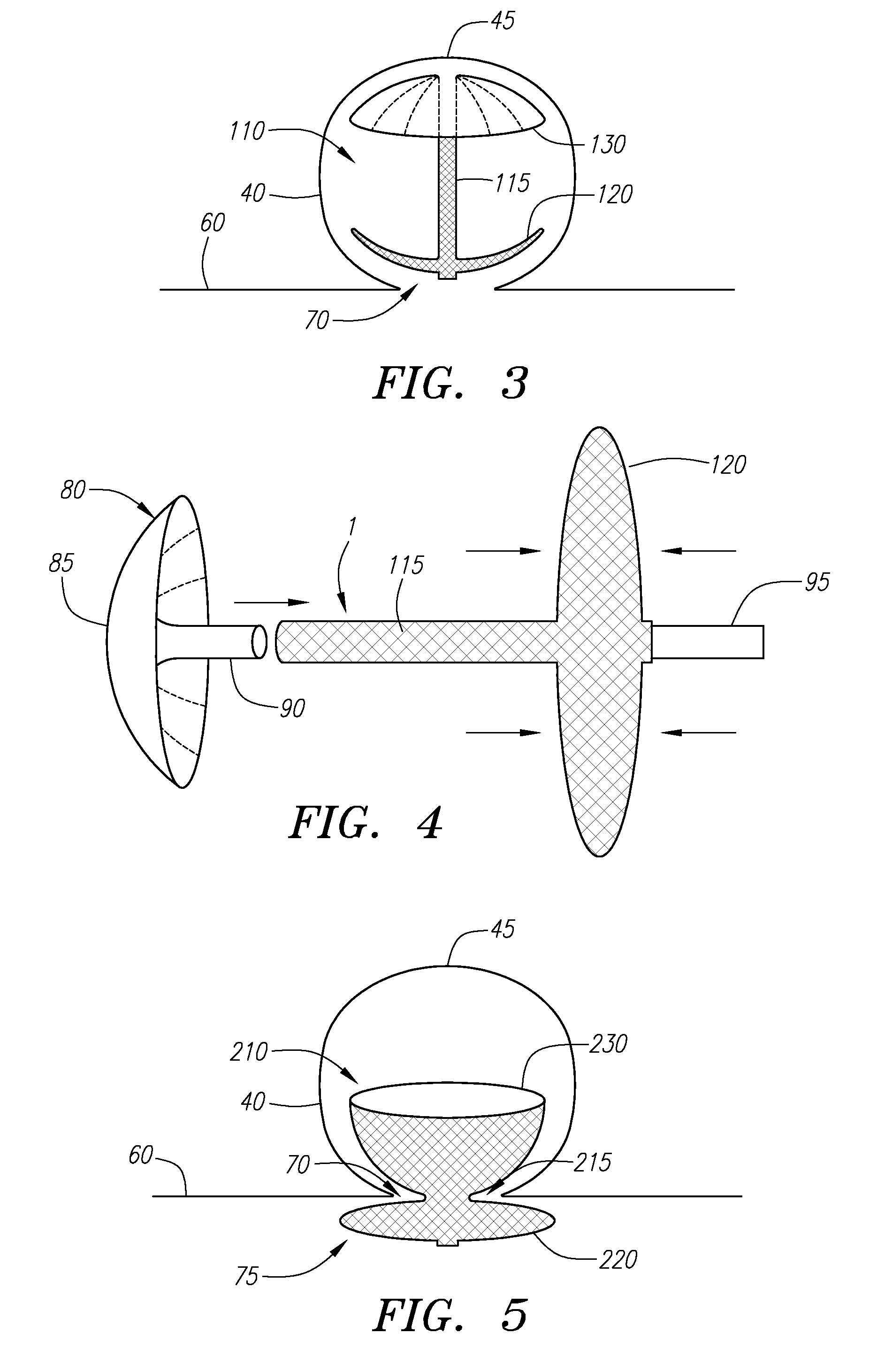System and method for retaining vaso-occlusive devices within an aneurysm