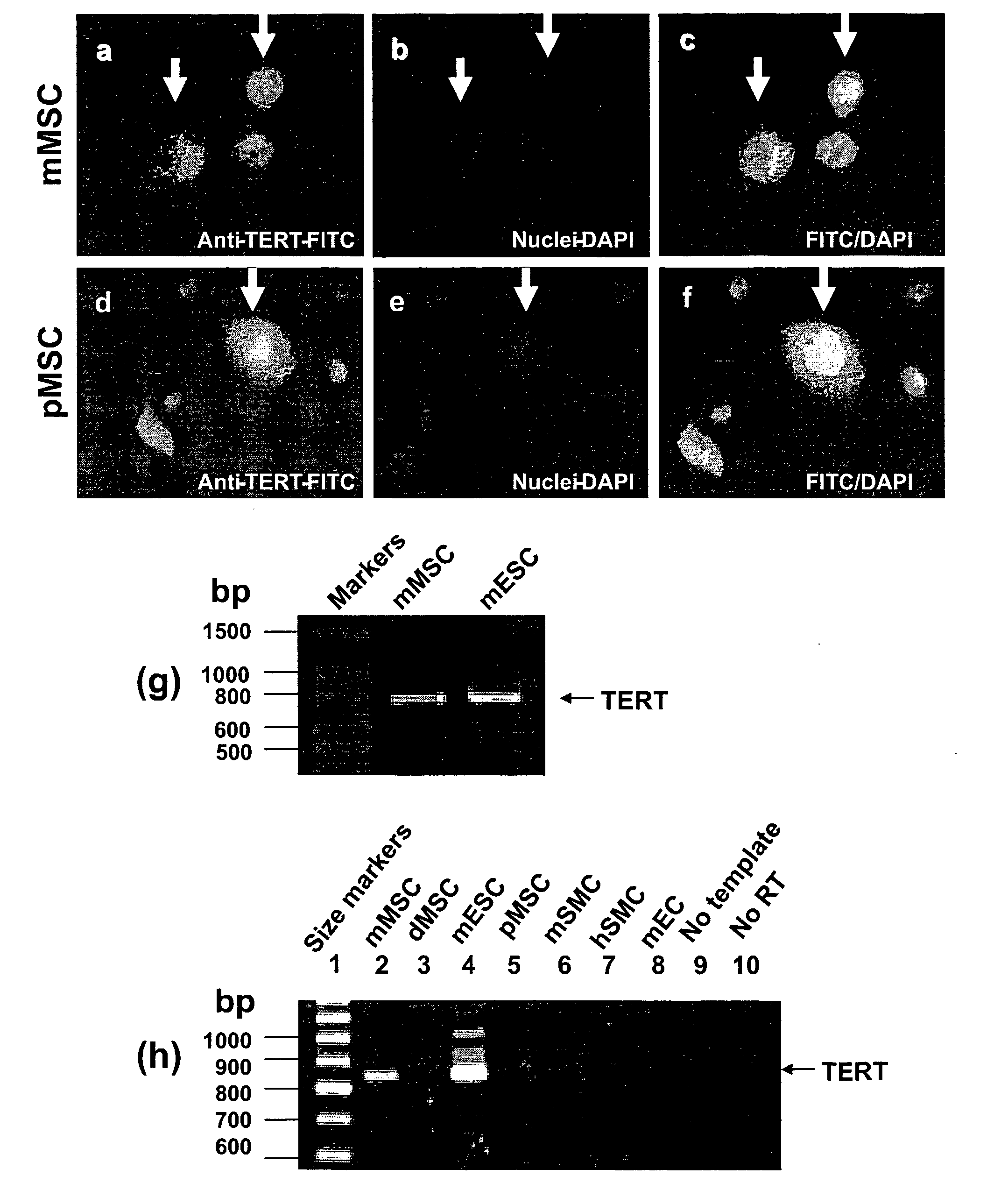 Compositions and Methods for Myogenesis of Fat-Derived Stem Cells Expressing Telomerase and Myocardin