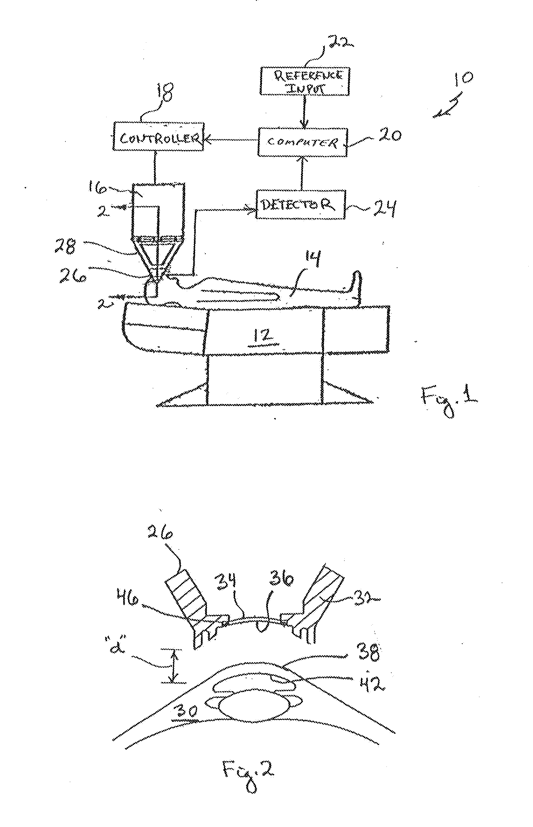 Apparatus and Method for Control of Refractive Index Changes in a Material