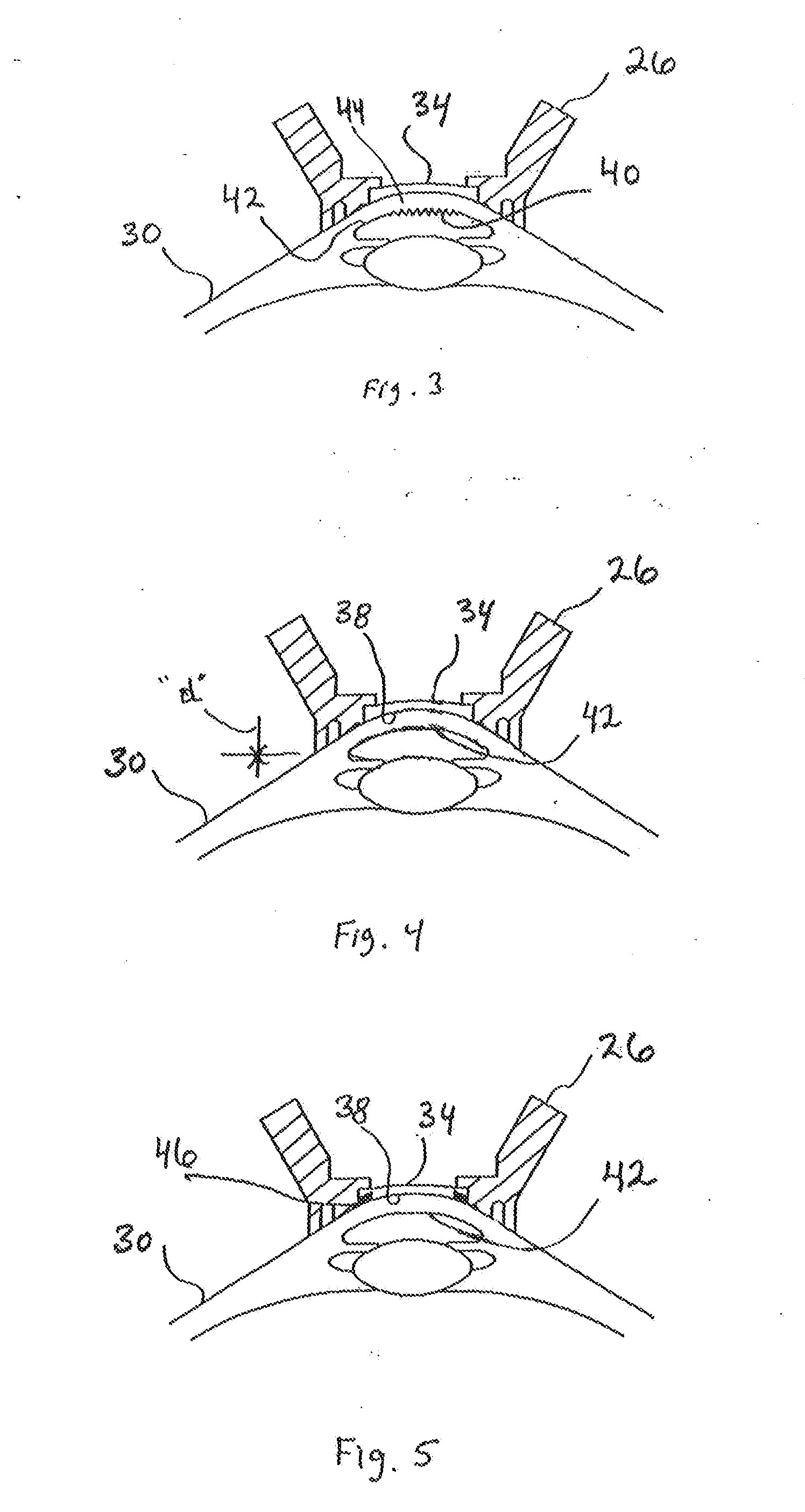 Apparatus and Method for Control of Refractive Index Changes in a Material