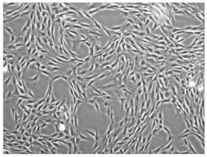 Method for efficiently obtaining adipose-derived mesenchymal stem cells from trace fat