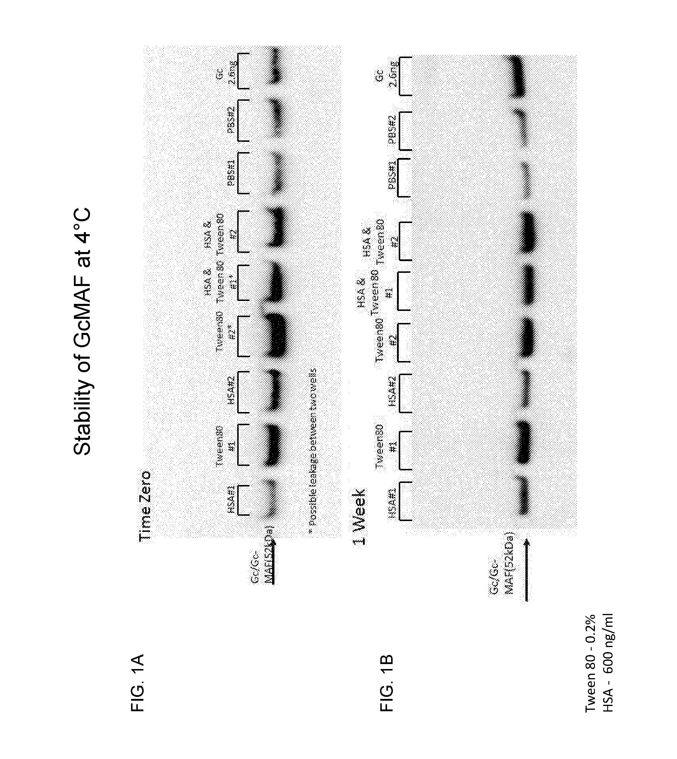 Compositions comprising gc-macrophage activating factor and uses thereof