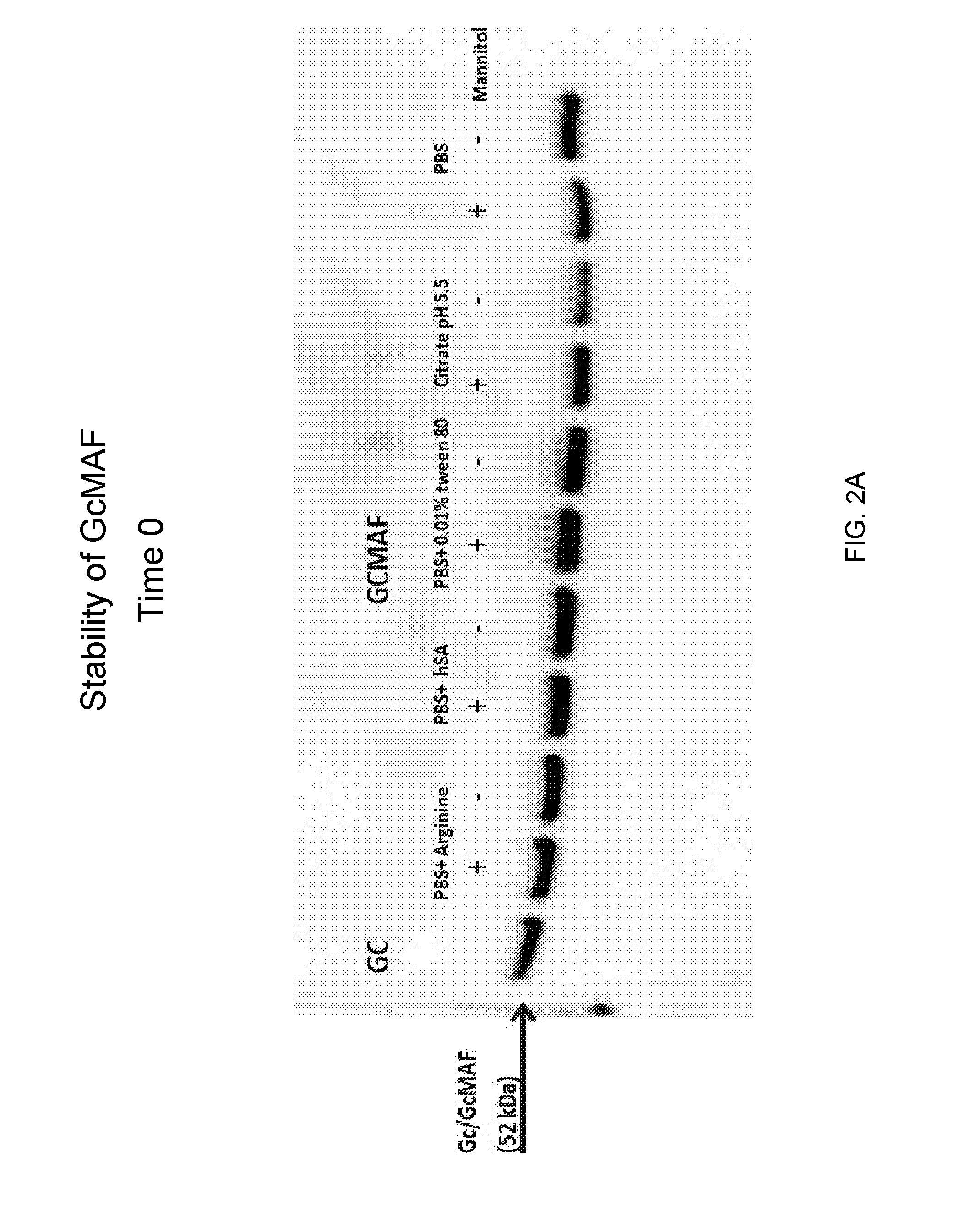 Compositions comprising gc-macrophage activating factor and uses thereof