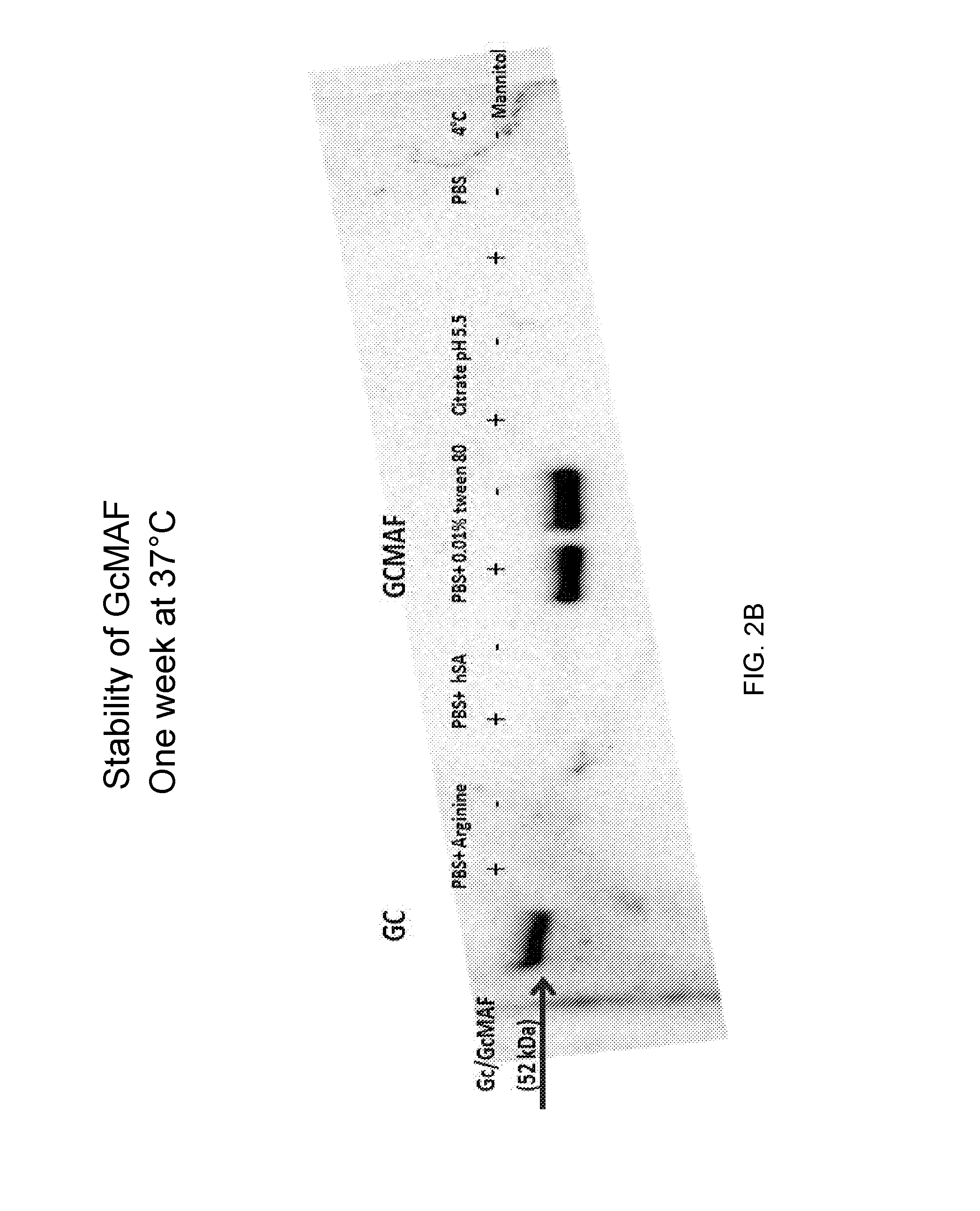 Compositions comprising gc-macrophage activating factor and uses thereof