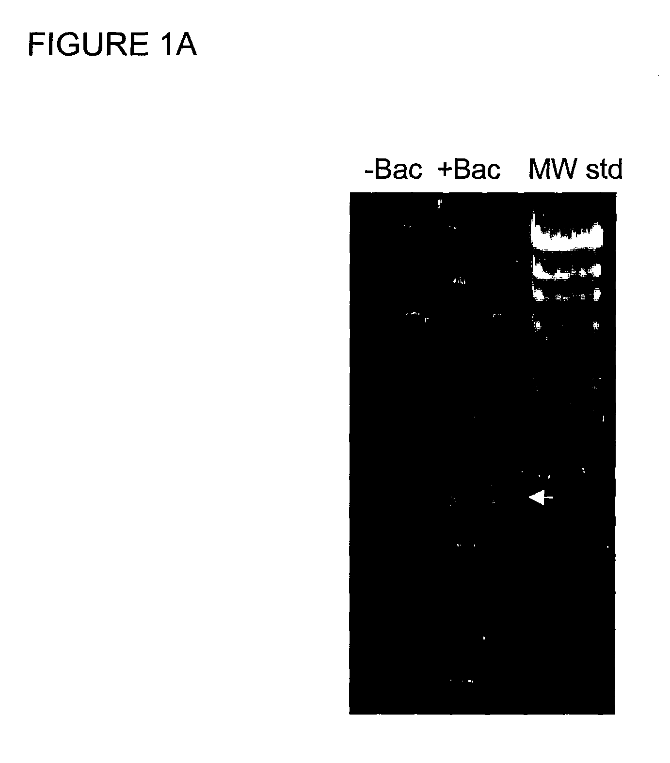 Methods and compounds for prevention and treatment of elevated intraocular pressure and related conditions