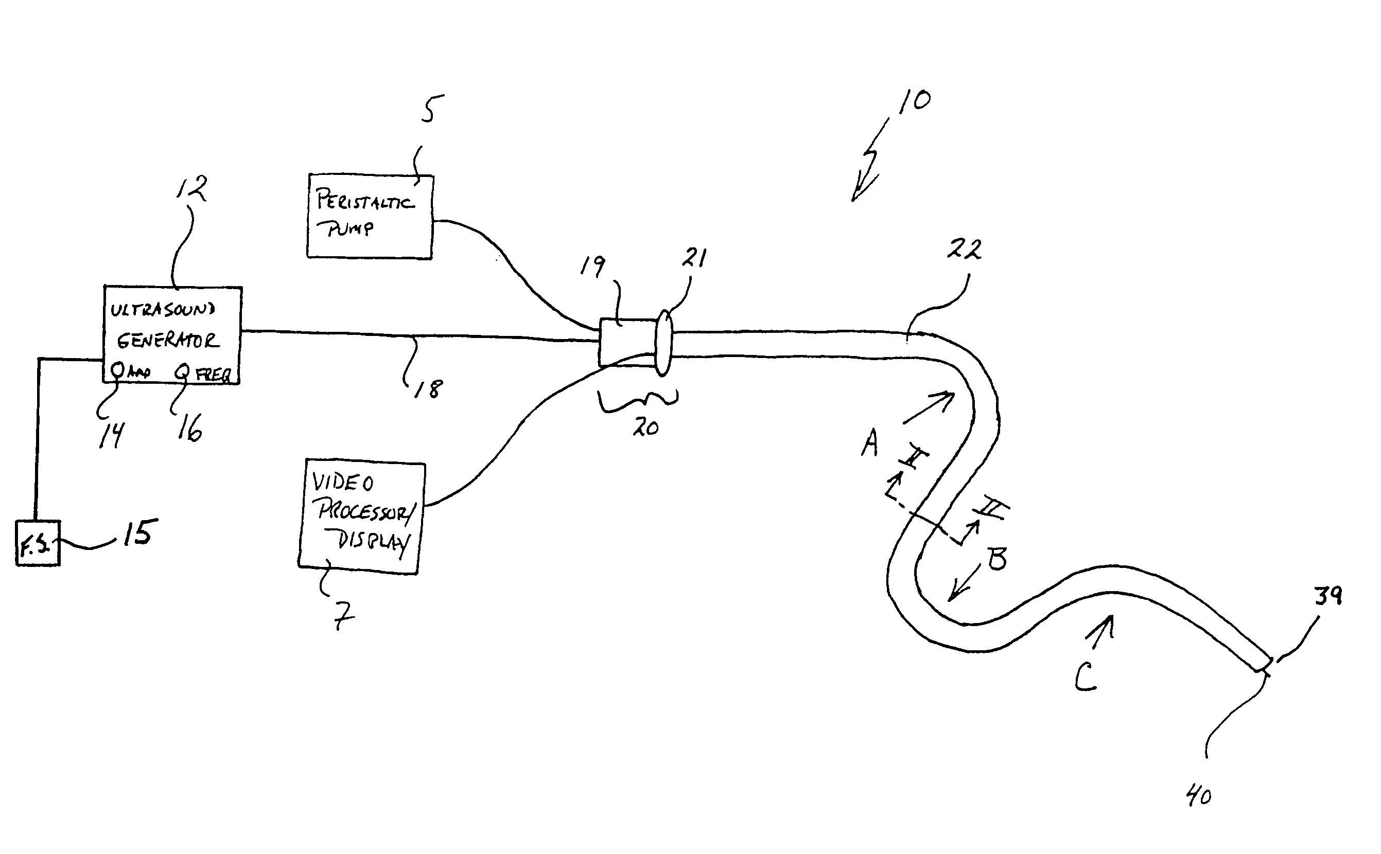 Flexible ultrasonic wire in an endoscope delivery system