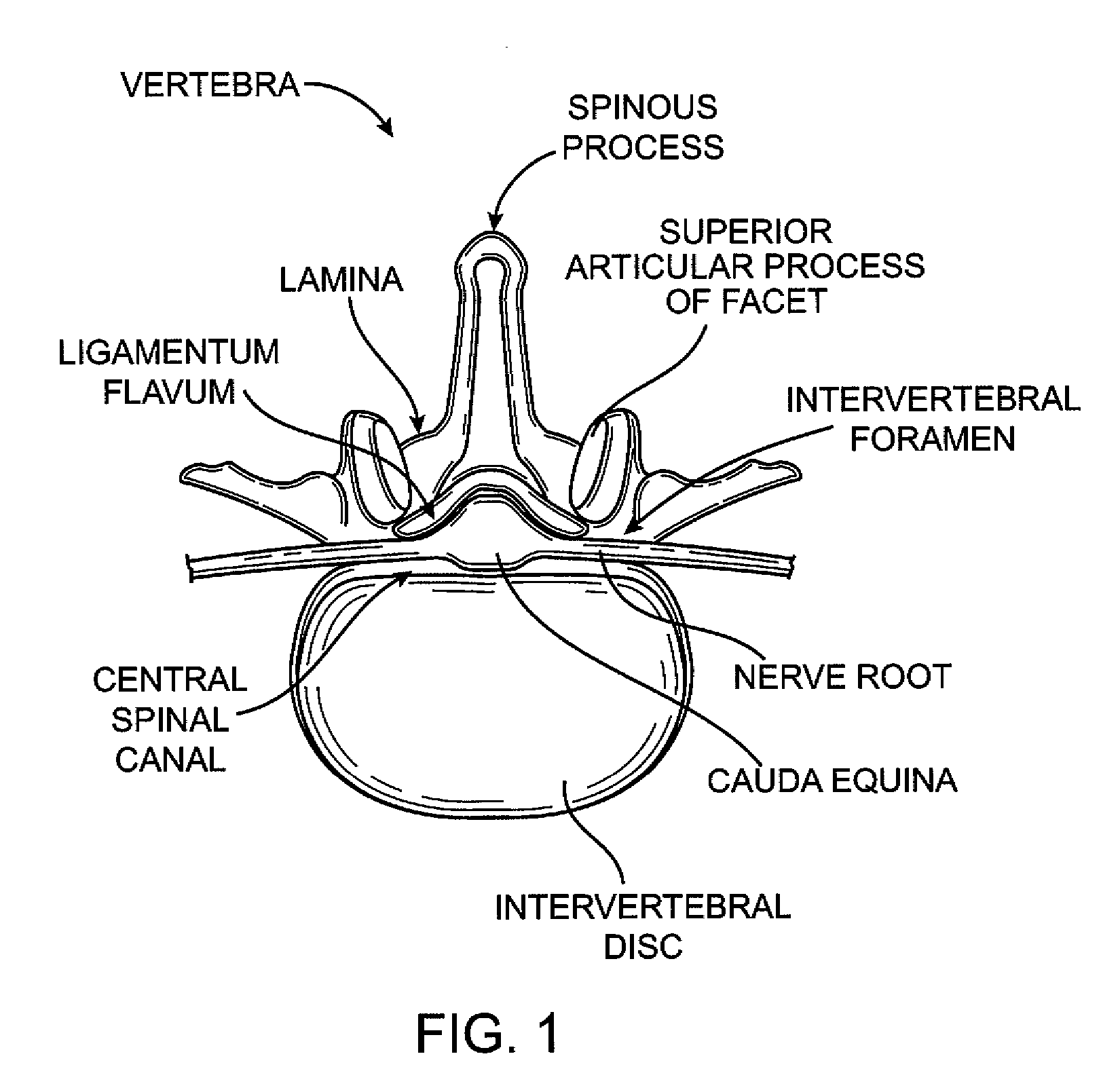 Flexible Tissue Removal Devices and Methods