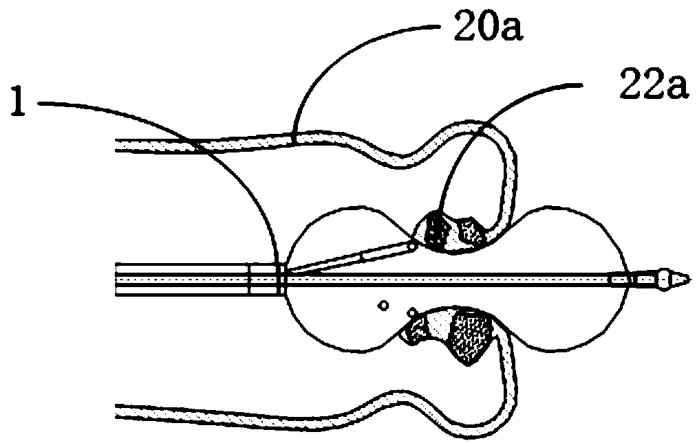 Apparatus for treating cardiac valve and vascular calcification and method of using the same