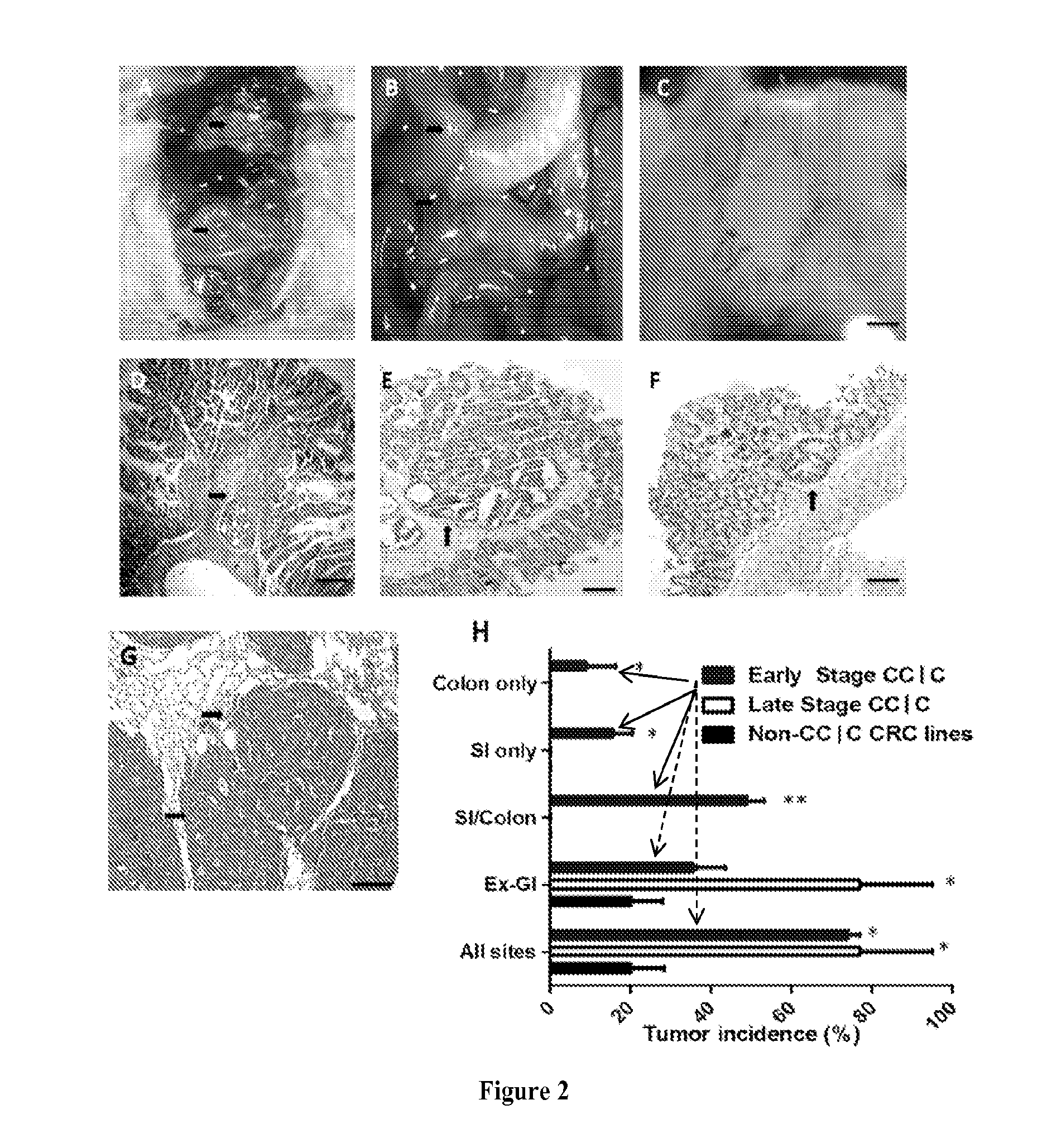 Compositions and methods useful for making orthotopic tumors with controllable metastasis