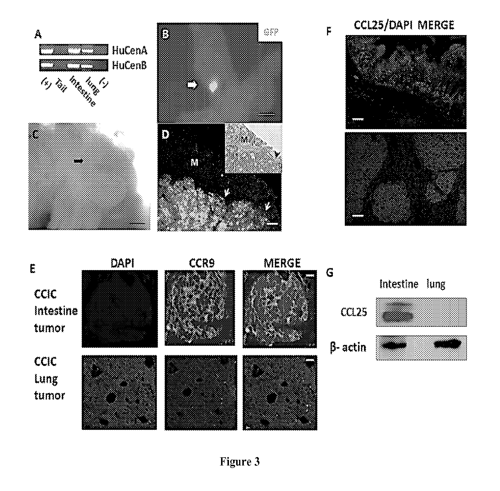Compositions and methods useful for making orthotopic tumors with controllable metastasis