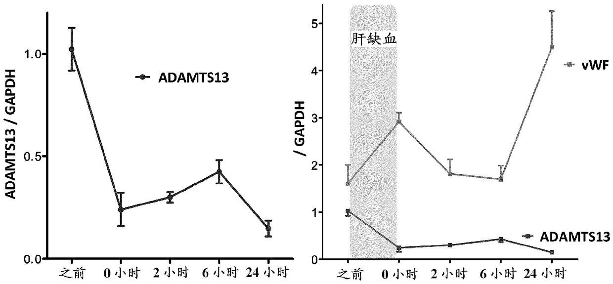 Diagnostic agent and medicine comprising adamts13 as main ingredient