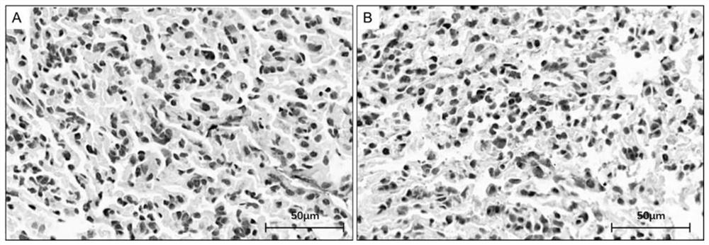 A polypeptide specifically binding to Mycobacterium tuberculosis, its encoding gene and application