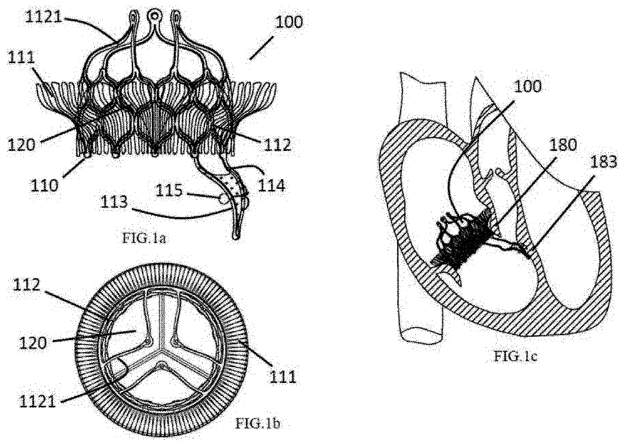 Heart valve prosthesis anchored to interventricular septum and conveying and releasing method thereof