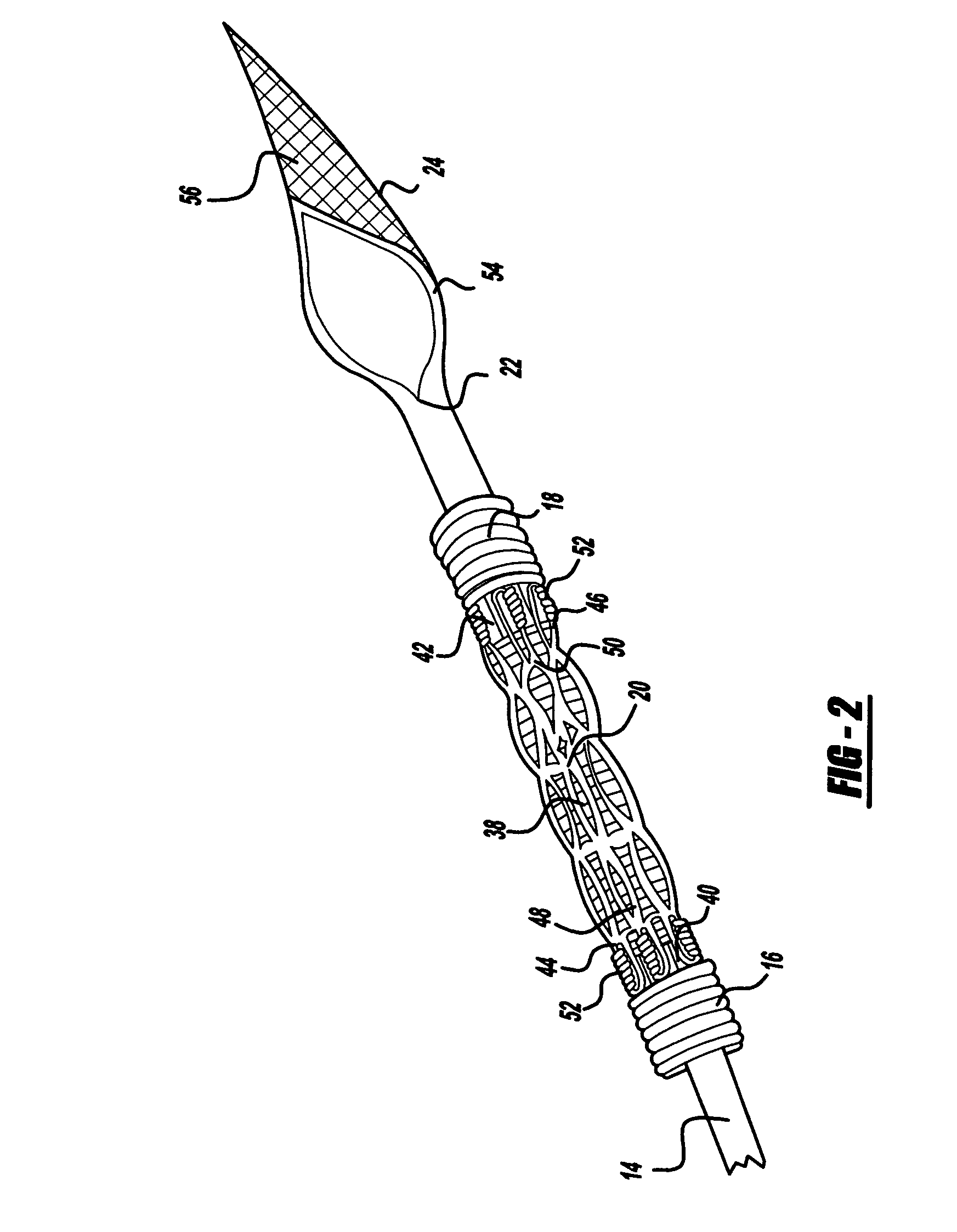 Self-expanding stent and stent delivery system with distal protection