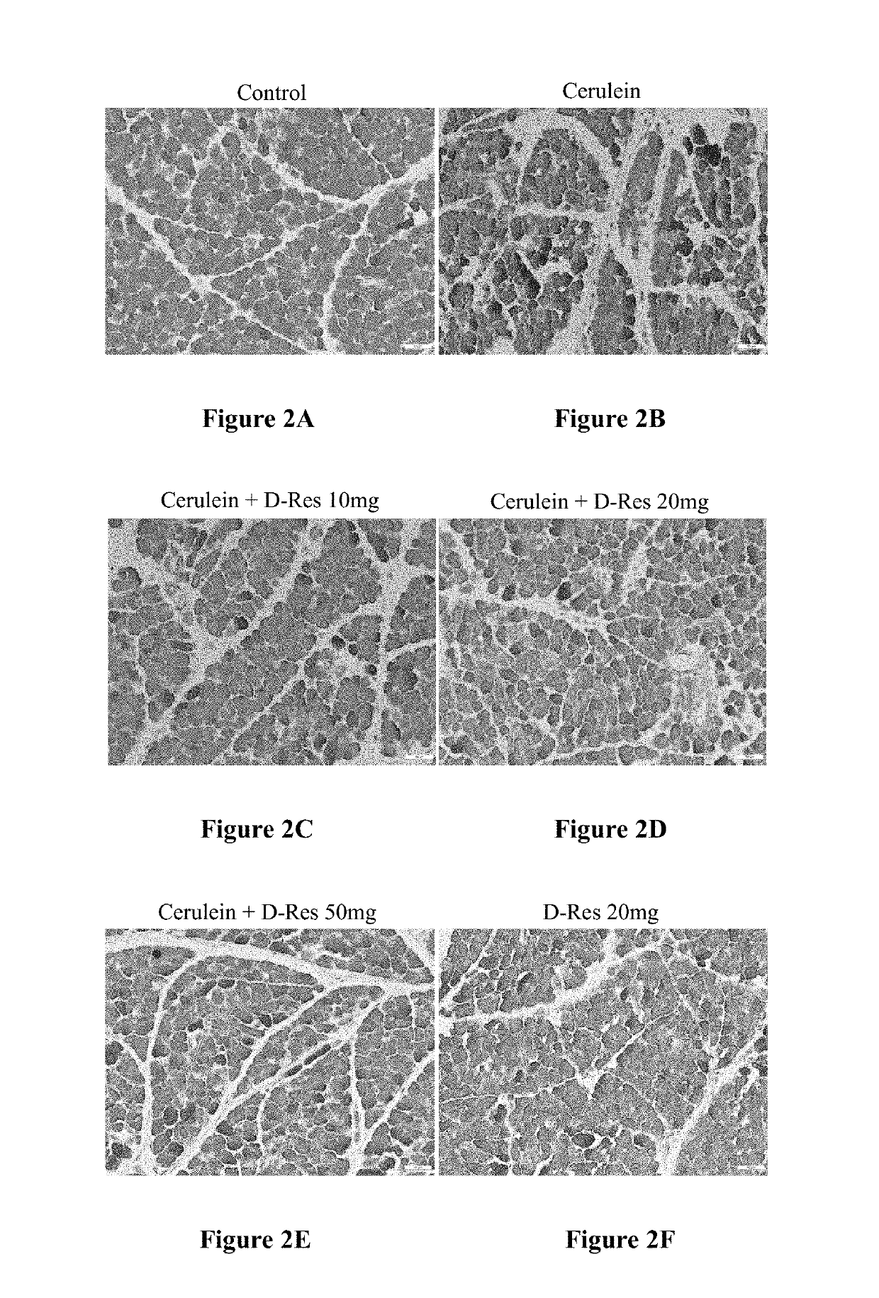 Method of using of dihydro-resveratrol or its stilbenoid derivatives and/or chemical variants as antimicrobial agents