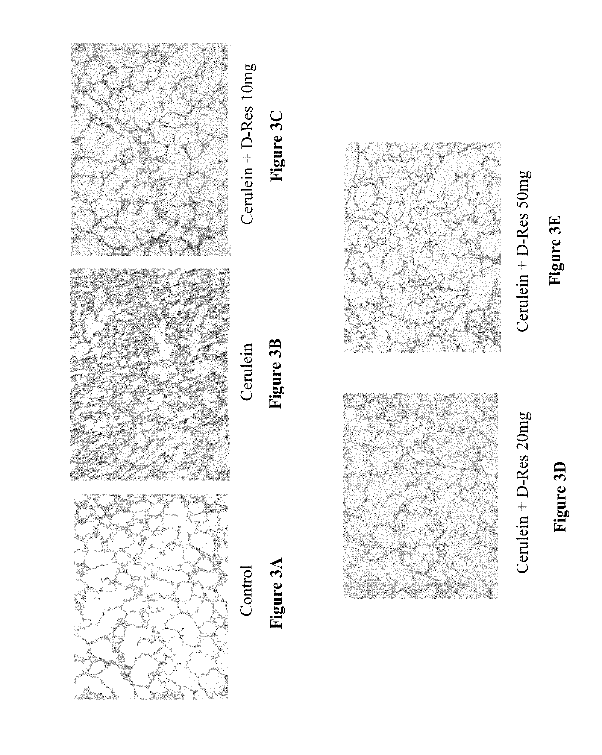 Method of using of dihydro-resveratrol or its stilbenoid derivatives and/or chemical variants as antimicrobial agents