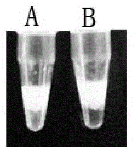 Novel bunyavirus reverse transcription loop-mediated isothermal amplification detection method and kit