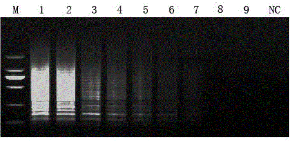 Novel bunyavirus reverse transcription loop-mediated isothermal amplification detection method and kit