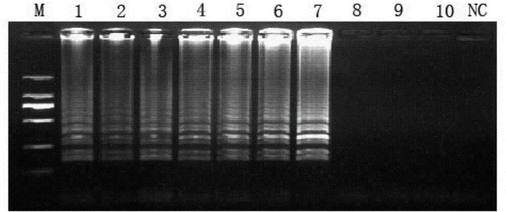 Novel bunyavirus reverse transcription loop-mediated isothermal amplification detection method and kit