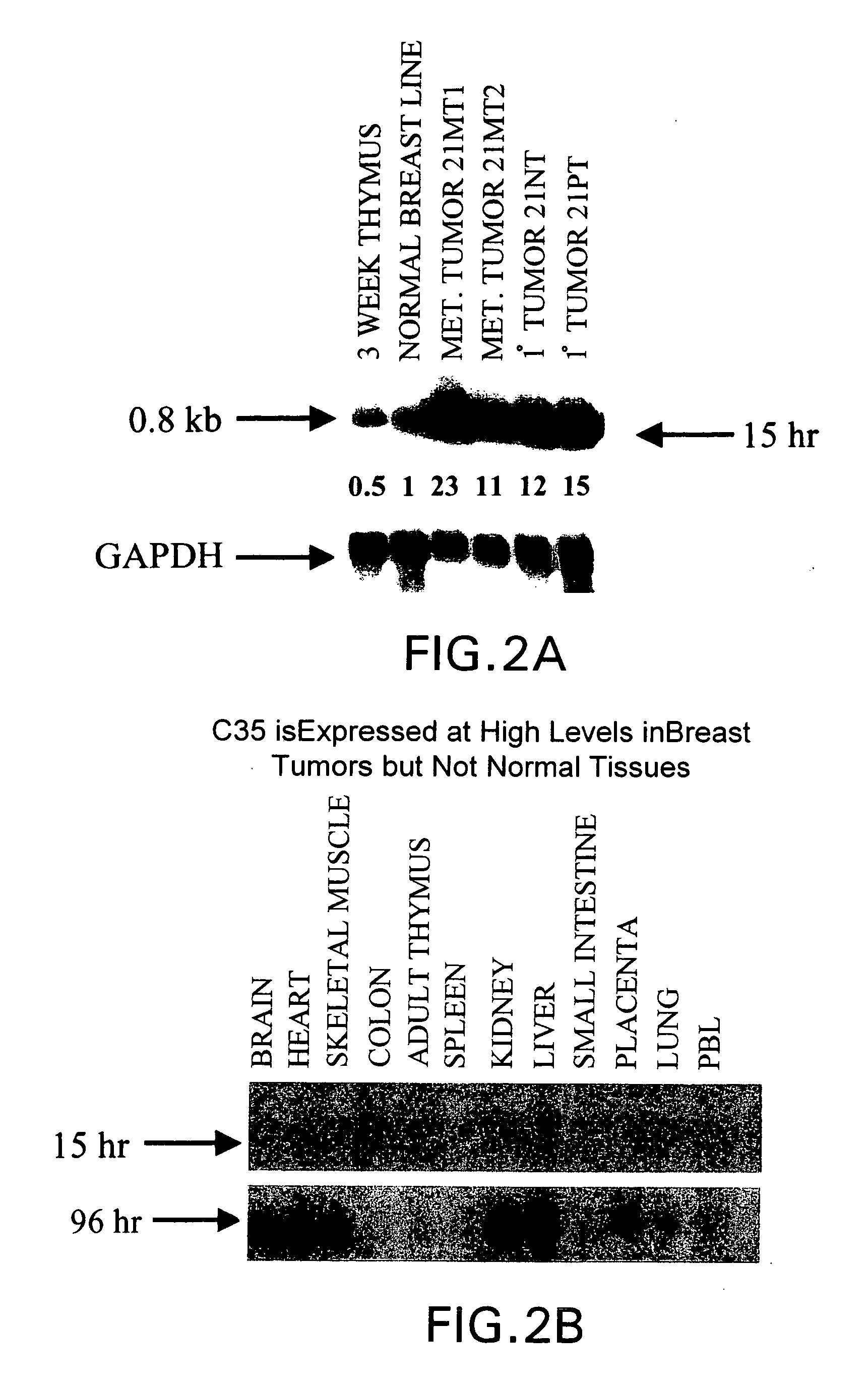 Gene differentially expressed in breast and bladder cancer, and encoded polypeptides