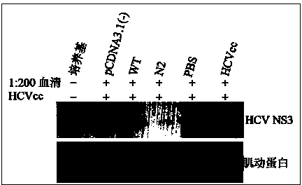 DNA (deoxyribonucleic acid) vaccine of HCV (hepatitis C virus) and preparation method thereof