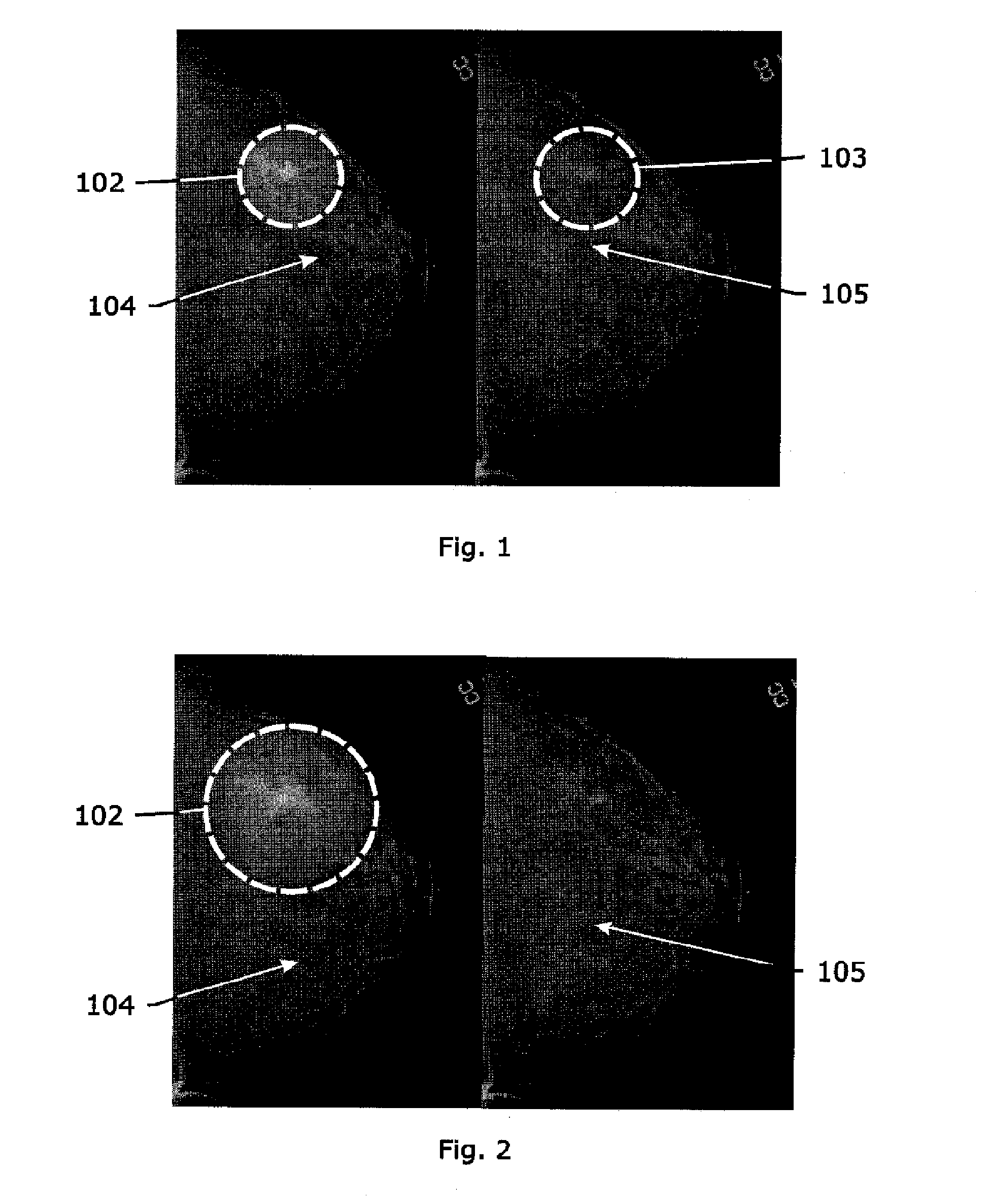 Method and system for improving the visibility of features of an image