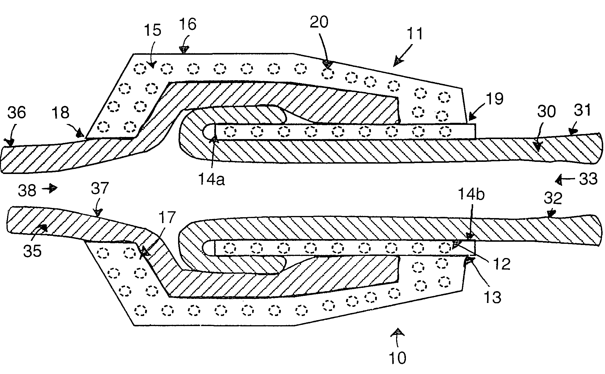 Method and device for anastomoses