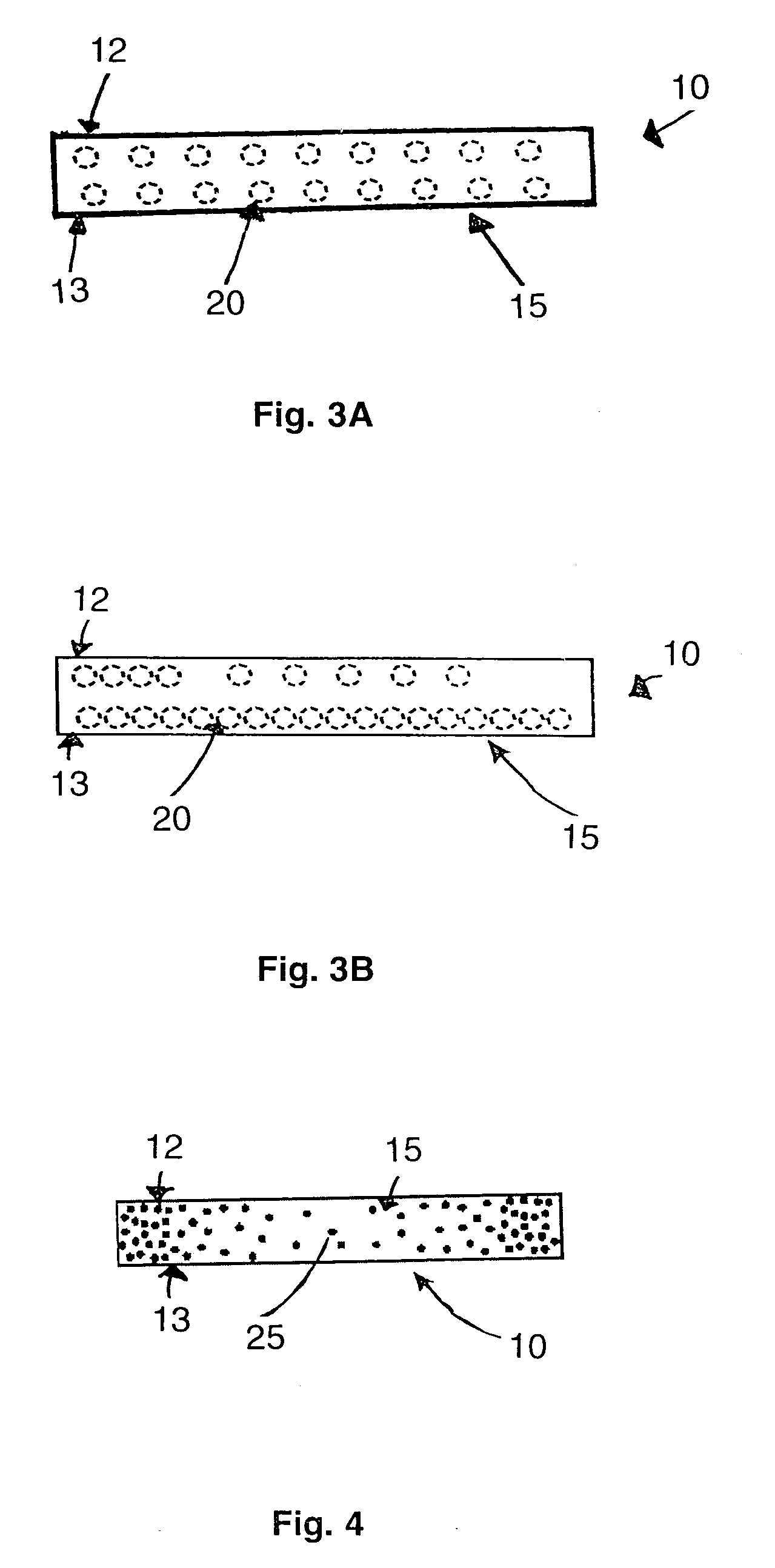Method and device for anastomoses